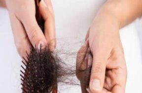 ખરતા વાળ